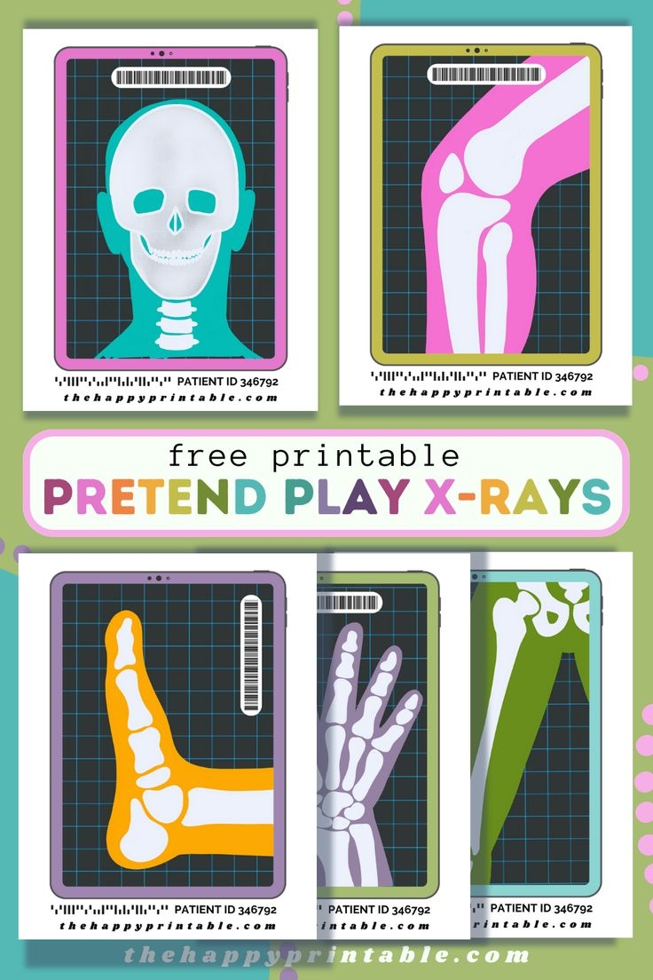 Free Printable X Ray Pictures
