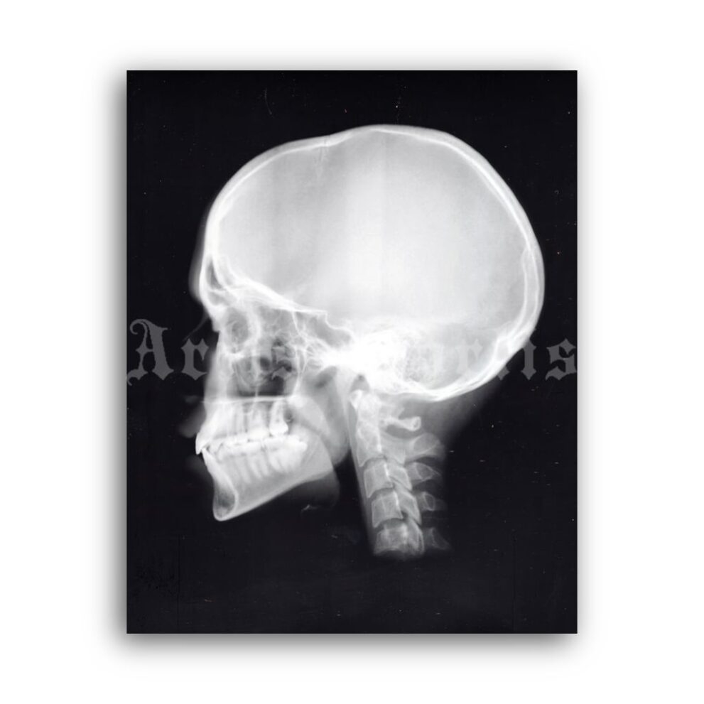 Printable X Ray Human Skull Lateral View Medical Radiology Poster