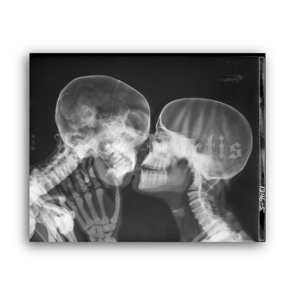 Printable X Ray Kiss Kissing Skeletons Vintage Medical 