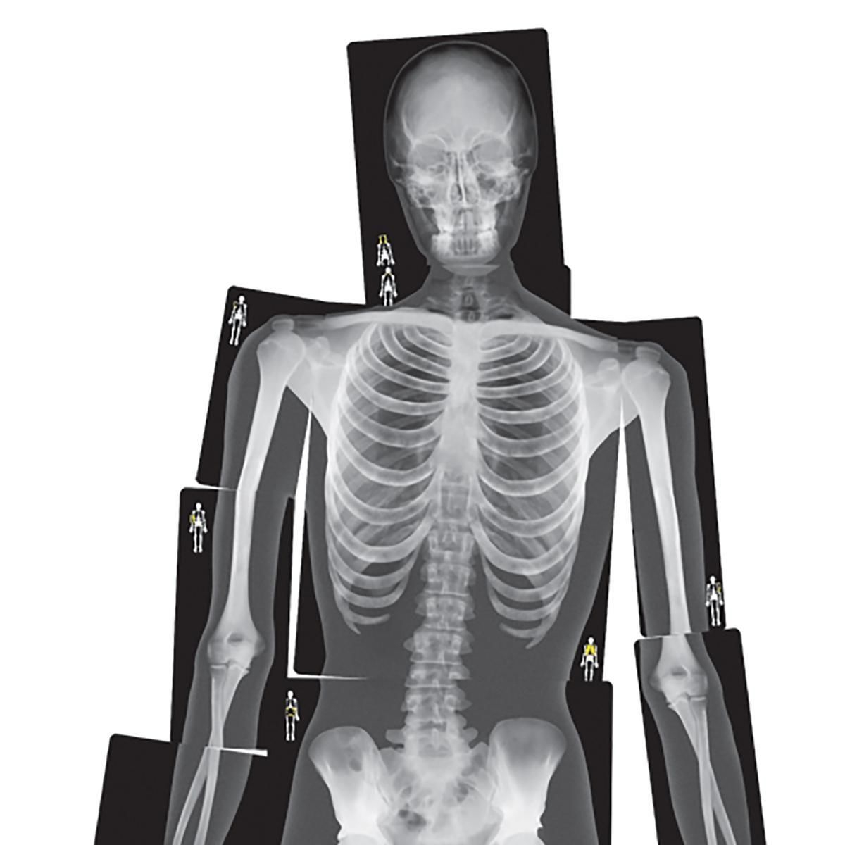 Printable X Ray Pictures