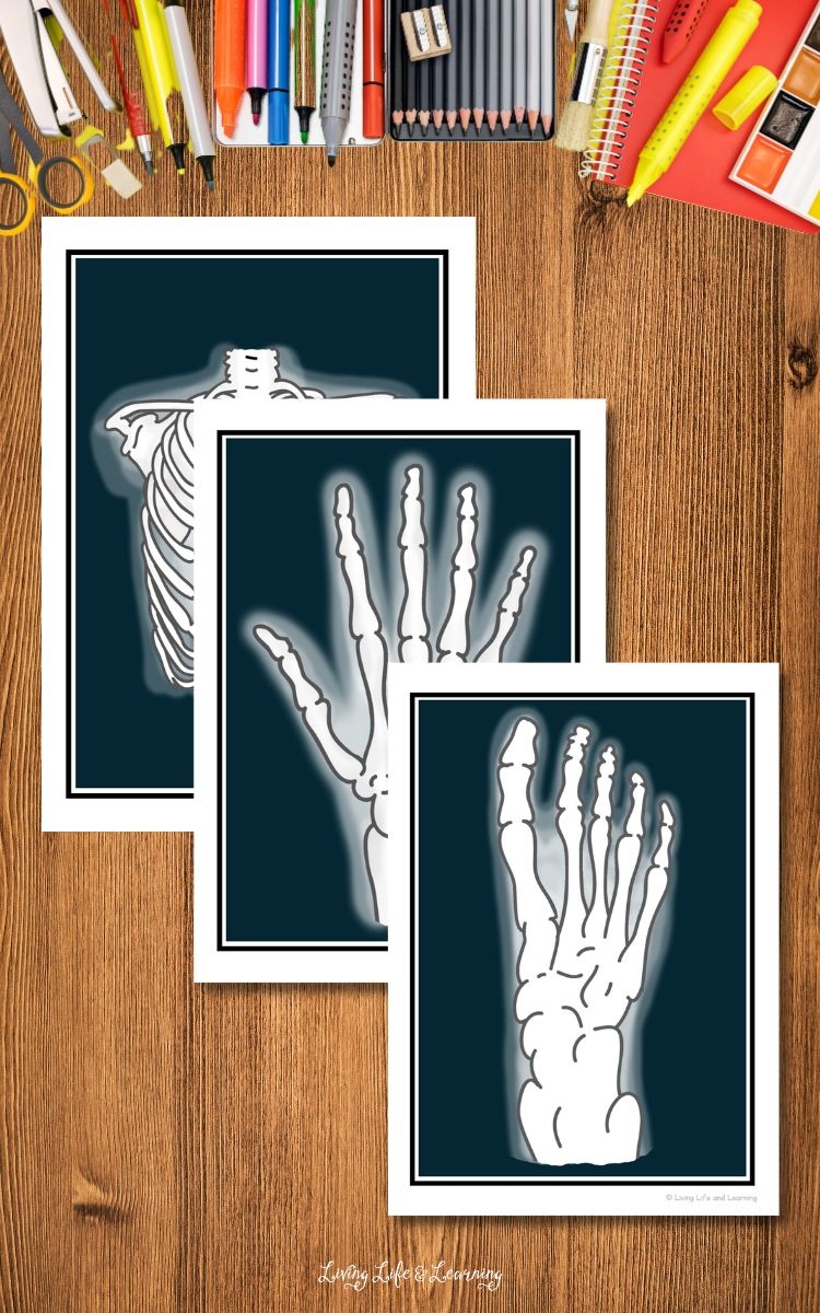 X ray Printables